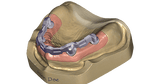 exocad Bar (Perpetual Upgrade)