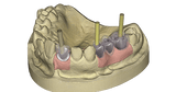 exocad Implant (Perpetual Initial Purchase)