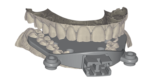 exocad Jaw Motion Import (Perpetual Upgrade)