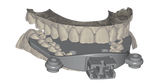 exocad Jaw Motion Import (Perpetual Upgrade)