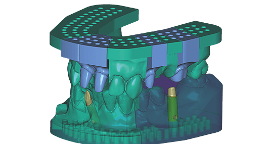 exocad Model Creator (Perpetual Initial Purchase)
