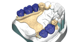exocad PartialCAD (Flex Initial Purchase)