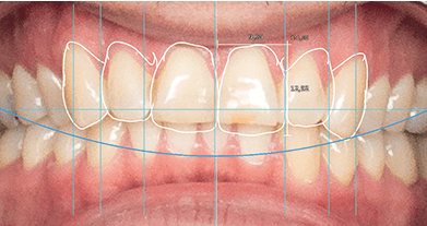exocad Smile Creator (Perpetual Initial Purchase)