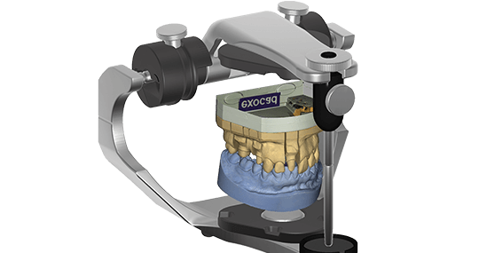 exocad Virtual Articulator (Perpetual Upgrade)
