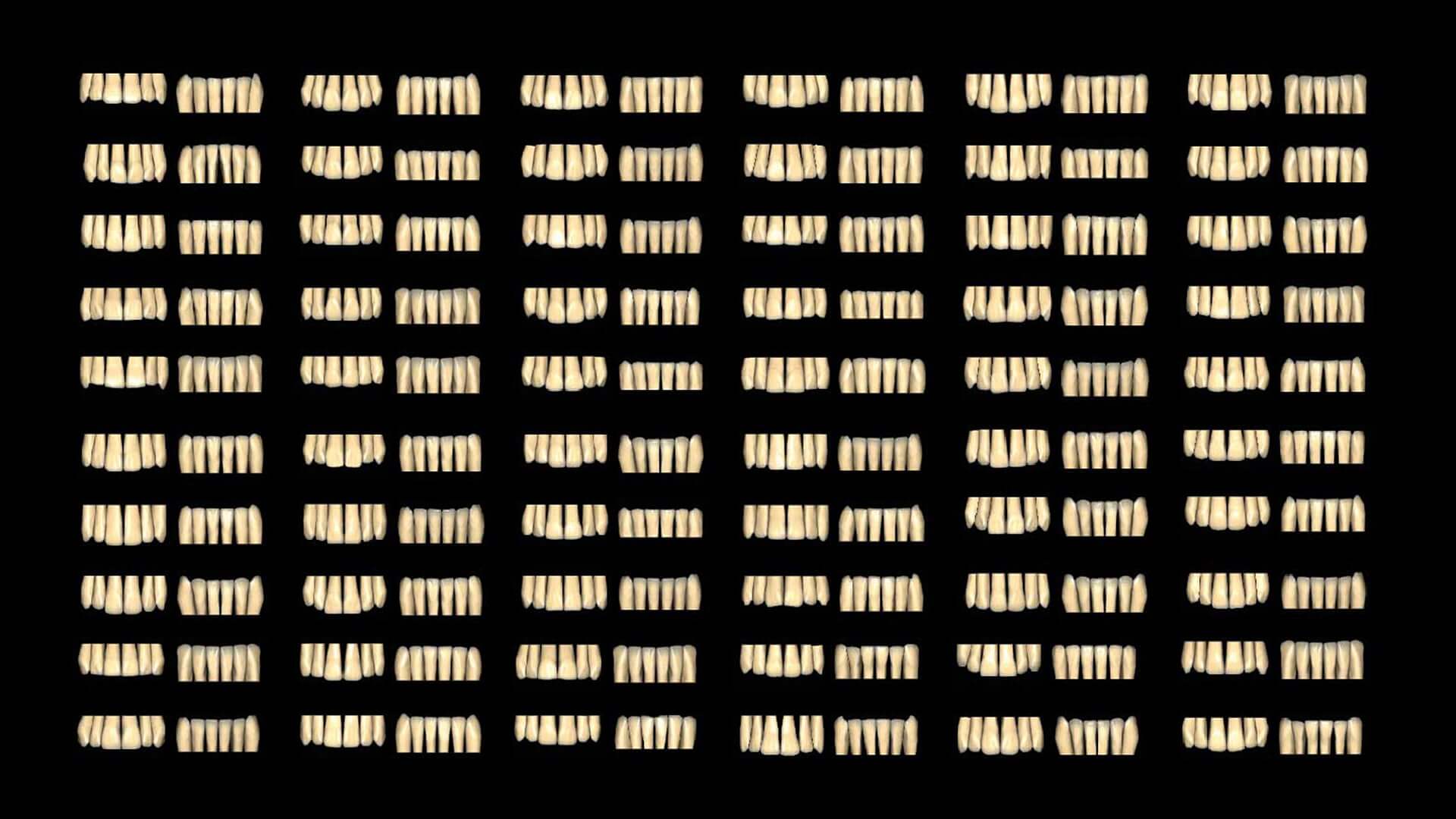 exocad Tooth Library (Flex Initial Purchase)